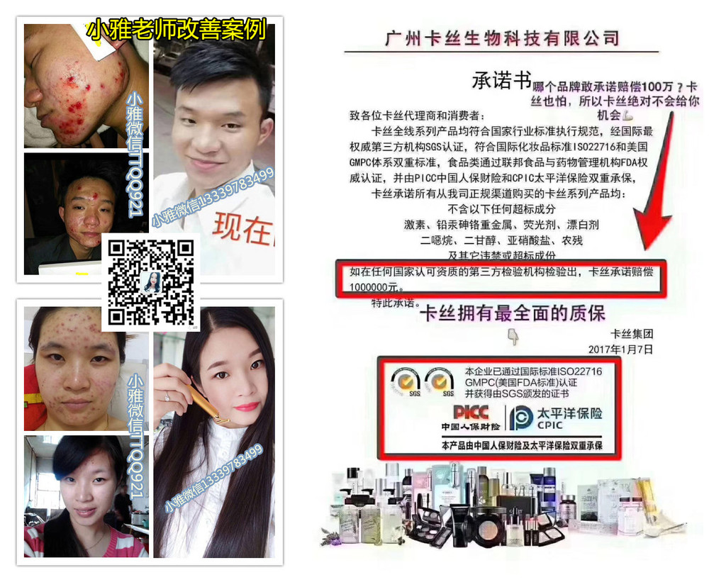 痘痘对比改善_副本_副本3.jpg